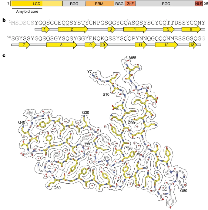 Nature：科學(xué)家識(shí)別出與人類(lèi)額顳葉癡呆癥發(fā)生相關(guān)的新型蛋白質(zhì)